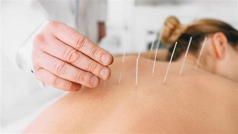 Acupuncture Healthcare