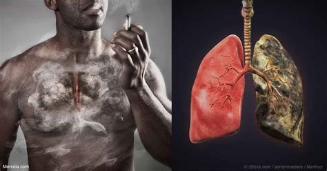 Adverse Health Effects Of Smoking