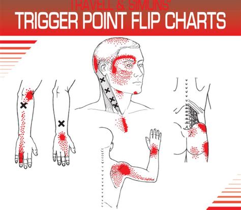 Althea Health Trigger Point