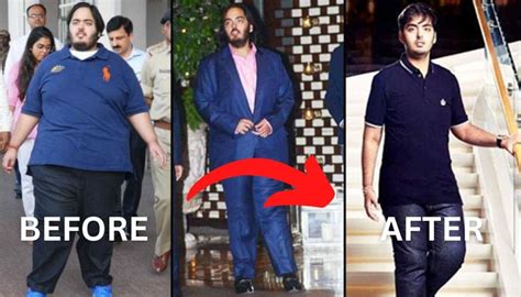 Anant Ambani Weight Loss Journey