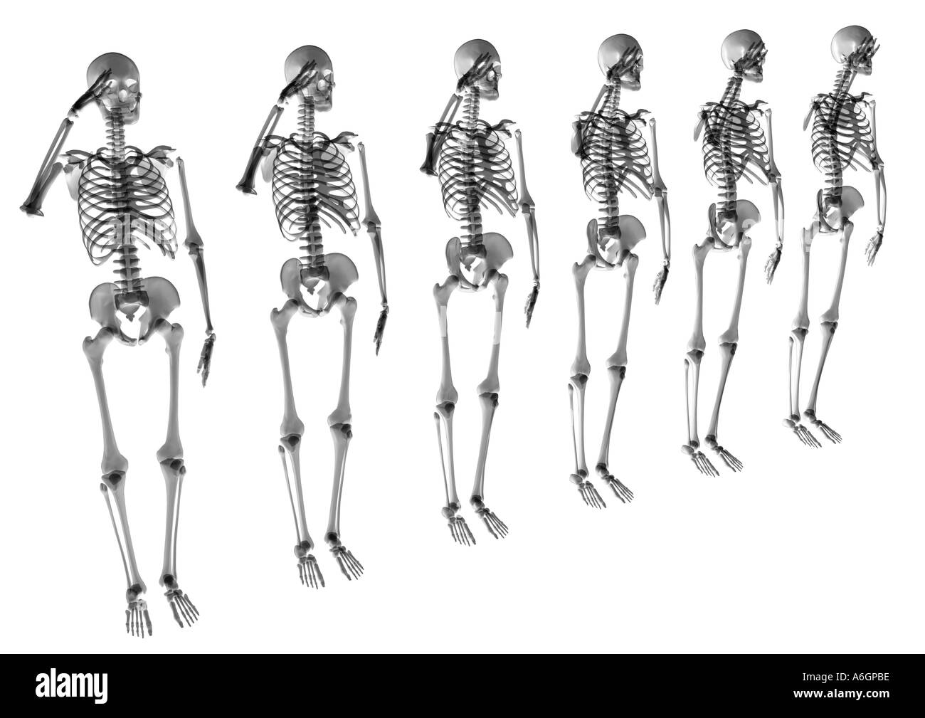 Army X Ray Program