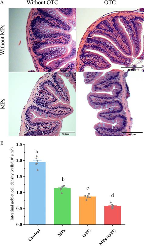 Assessment Of Nonalcoholic Fatty Liver Disease Symptoms And Gut Liver Axis Status In Zebrafish After Exposure To Polystyrene Microplastics And Oxytetracycline Alone And In Combination Environmental Health Perspectives Vol 131 No 4