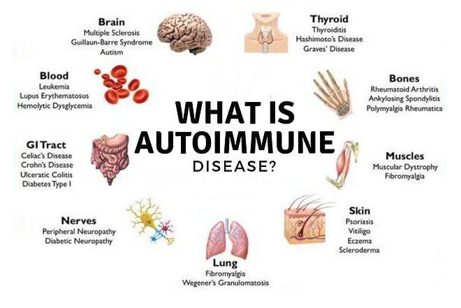 Autoimmune Disease Rates By State