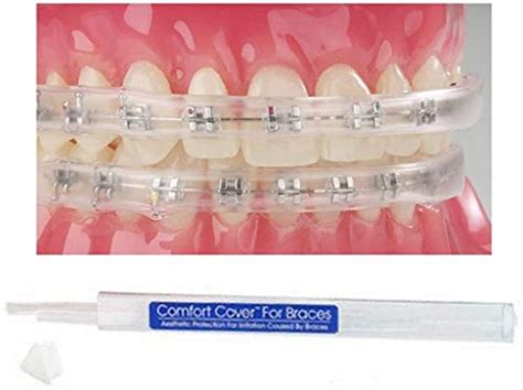 Best Comfort Covers For Braces How To Choose The Right One