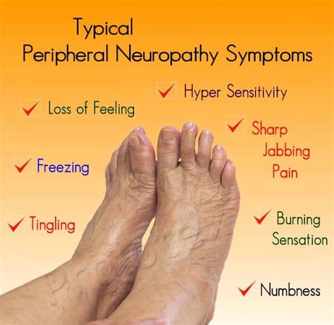 Idiopathic Neuropathy Best Health Routine