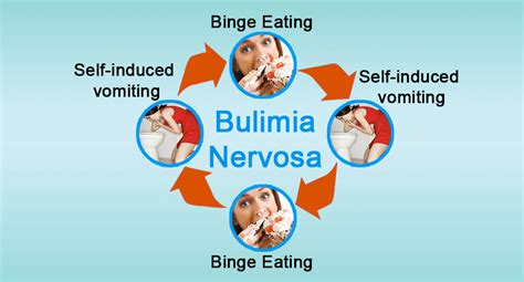 Bulimia Nervosa Bn Steadfast Nutrition