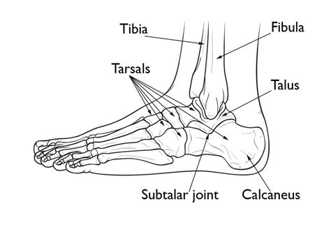 Calcareous Spines In Human Feet