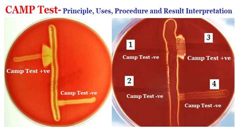 Camp Stands For In Microbiology