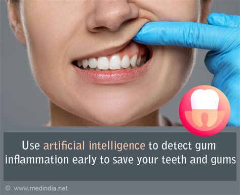 Catch Inflamed Gums Early With Ai