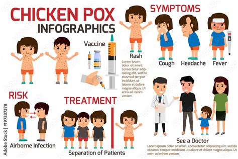 Children Has Chicken Pox Infographic Poster Children Fever And