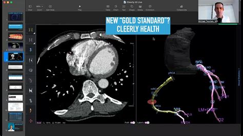 Cleerly Health Heart Scan