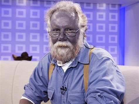 Colloidal Silver Ingestion