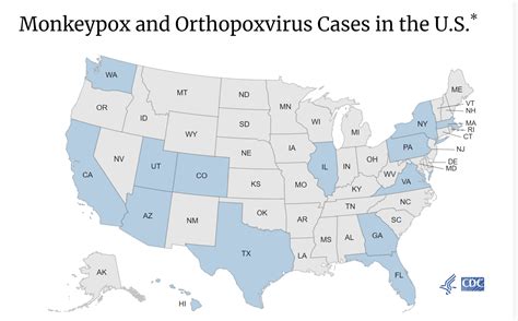 Dallas County Reports The First Monkeypox Viral Infections Transmitted Locally Dallas City News