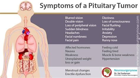 Damage To Pituitary Gland Symptoms