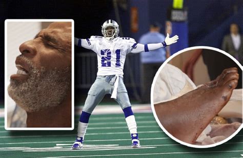 Deion Sanders Battles Diabetes