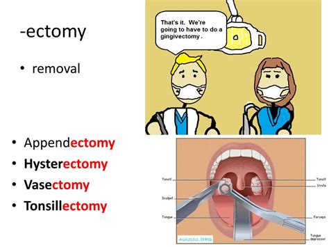 Ectomy Examples