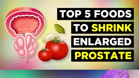 Foods That Shrink Prostate Gland