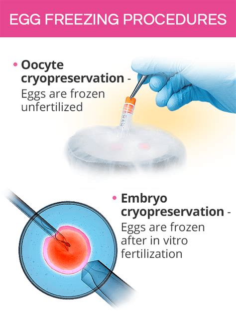 Freezing Eggs Shecares