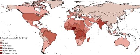 Global Strategies To Improve Outcomes In Sickle Cell Disease