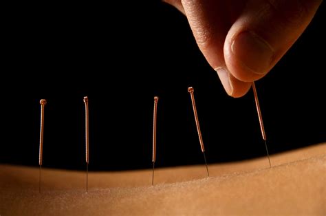 Greenlake Acupuncture