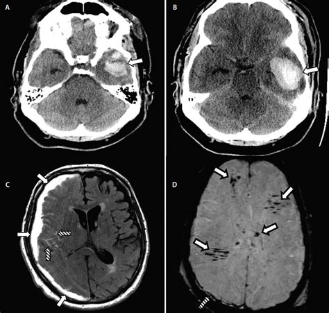 Head Injury Scan