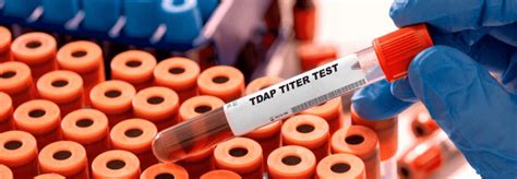 Health Department Titer Test