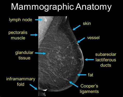 Health Images Mammogram Locations