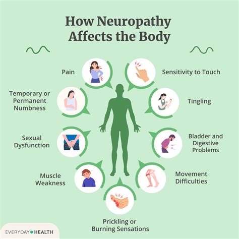 Idiopathic Neuropathy Mayo Clinic