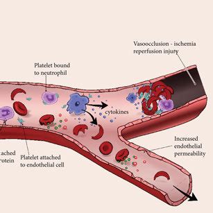 Inheritance Of Sickle Cell Disease In A Scenario Where Both Parents Download Scientific Diagram