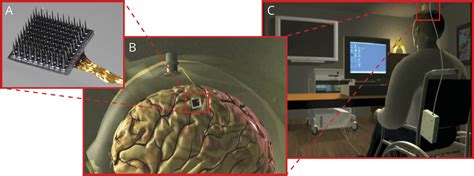 Interim Safety Profile From The Feasibility Study Of The Braingate Neural Interface System Neurology