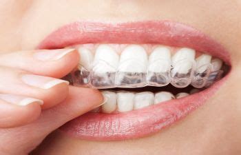 Invisalign Clear Dental Aligners And Your Health Dunwoody Ga