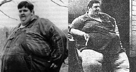 Jon Brower Minnoch Was An American Man Who Weighed At 1400 Lbs Known As The Heaviest Human Ever