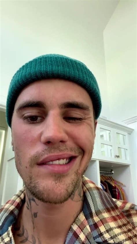 Justin Bieber Health Update