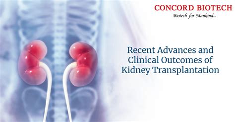 Kidney Transplantation Allina Health Minnesota