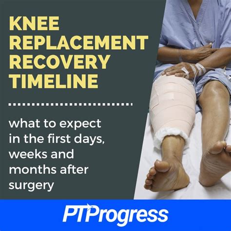 Knee Replacement Surgery What To Expect During Recovery Knee