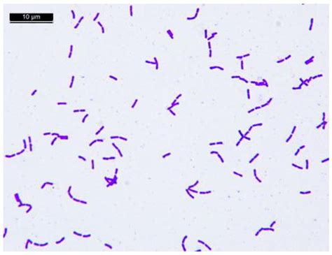 5 Lacticaseibacillus Benefits