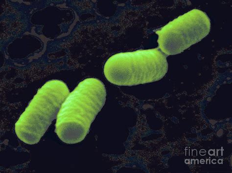 5 Risks Of Lactobacillus Curvatus