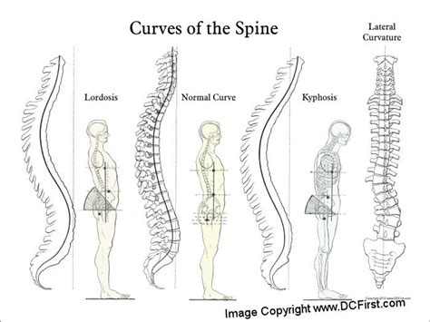 Lateral Curve Of The Spine