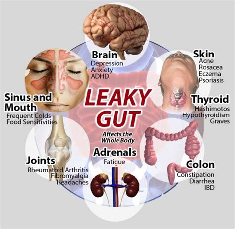 Leaky Gut And Skin Disorders