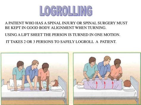 Logrolling Patient Definition