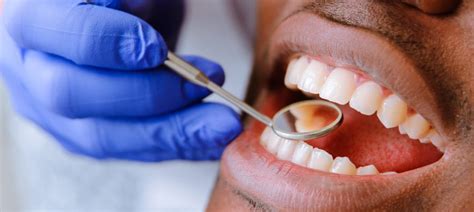 Low Income Dental Clinics Cincinnati