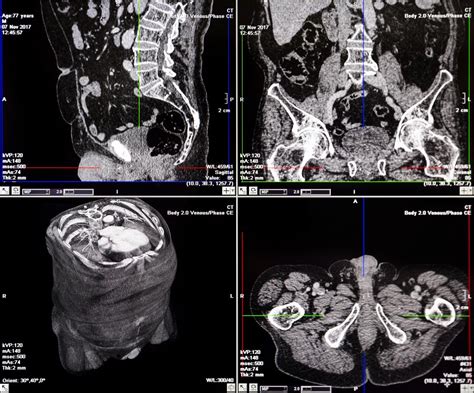 Main Line Health Ct Scan