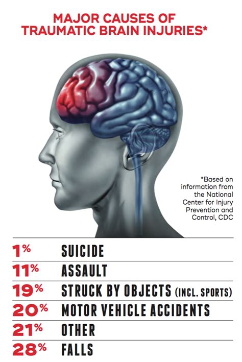 Mild Traumatic Brain Injury Images