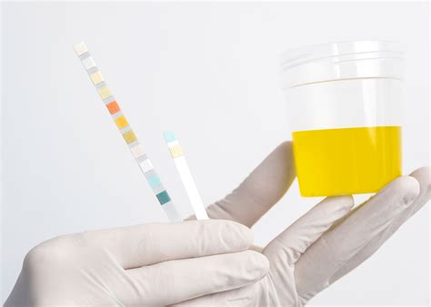 Minnesota Occupational Health Drug Testing