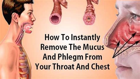 Mucus Clogging Throat