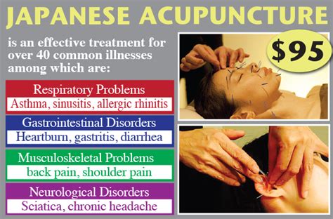 Natural Acupuncture