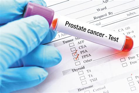 New Test For Prostate Cancer