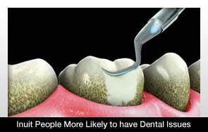 Nunavut Inuit Dental Problems