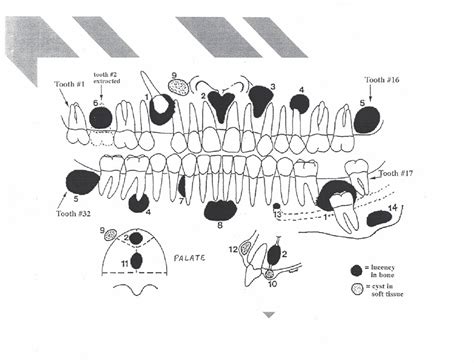 Oral Pathology Final Diagram Quizlet