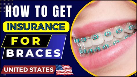 Orthodox Braces Covered By Insurance